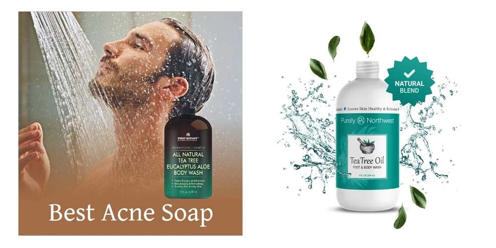 Treats Acne Successfully